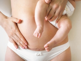 Fertility After Cesarean Section or Other Uterine Surgery 