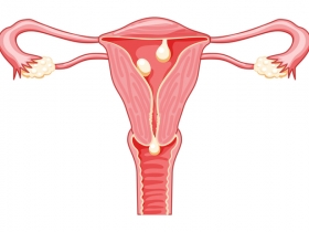 IVF and Thin Uterine Lining: Why Thickness Matters More Than You Think 
